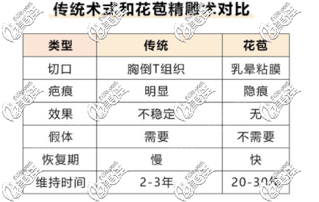 花苞精 雕提升术比传统双环更先进