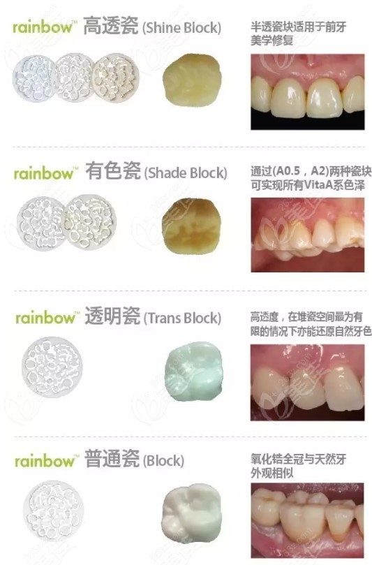 进口十大全瓷牙品牌盘点上榜的德国美国二氧化锆牙冠的价格你知晓吗