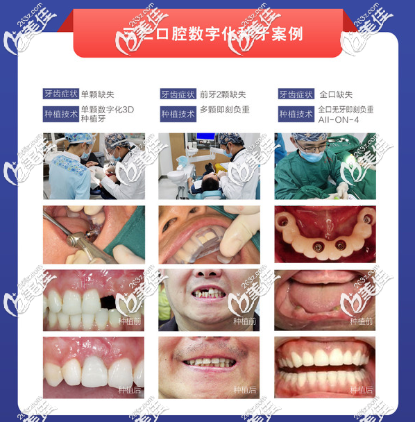广州三仁口腔医院种植牙技术怎么样