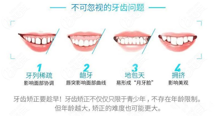 牙齿稀疏龅牙地包天做牙齿矫正要趁早