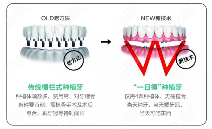 福州口腔医院种植牙费用在此韩国奥齿泰种植牙多少钱一颗嗖的就来了
