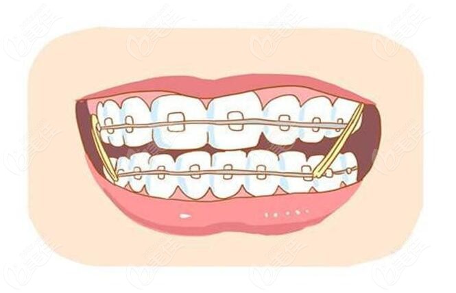 绵阳牙科医院哪家又好又实惠想选家做牙齿矫正口碑好的口腔诊所