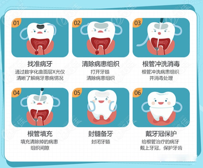 牙齿做根管治疗的过程