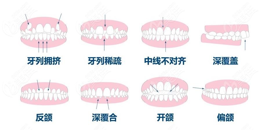 矫正牙齿去哪家口腔医院比较好?