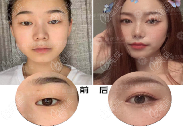 重庆华美李富强达芬奇眼综合效果图