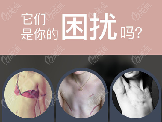 乳房再造手术痛苦吗