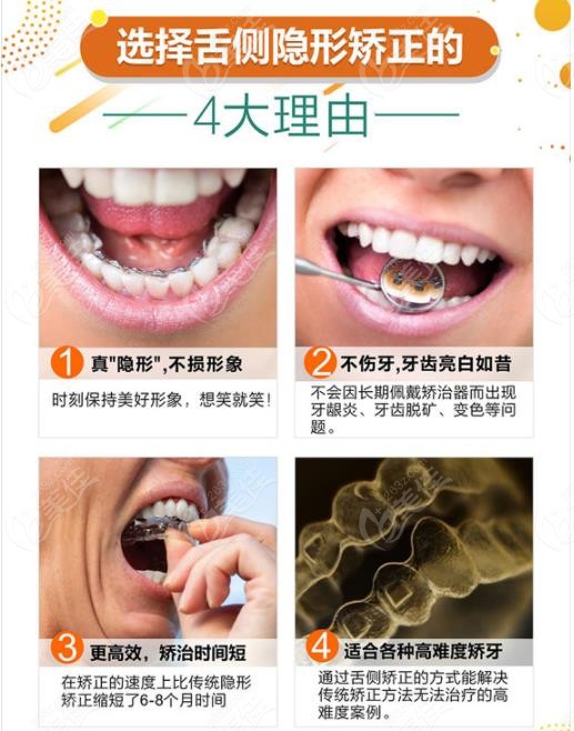 张景泉是广州中家医口腔的智能精控牙齿矫正带头人,已经从事正畸口腔
