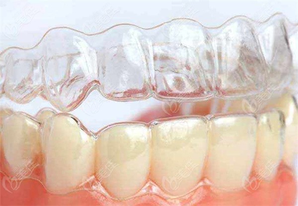 重庆维乐口腔和牙博士哪个好好奇哪家牙科做牙齿矫正更靠谱