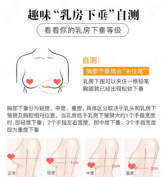 乳房下垂程度自测方法