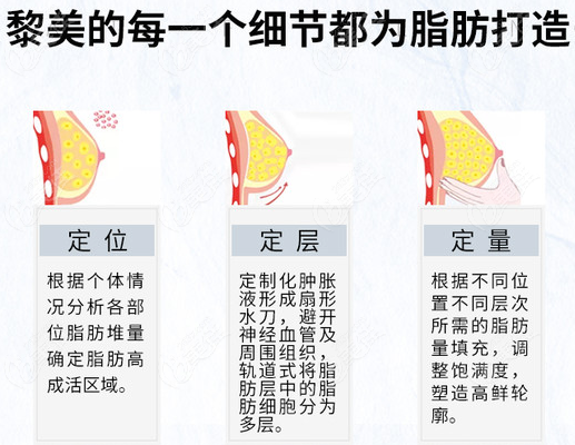 乌鲁木齐隆胸好的医院盘点假体隆胸和自体脂肪丰胸都做哦