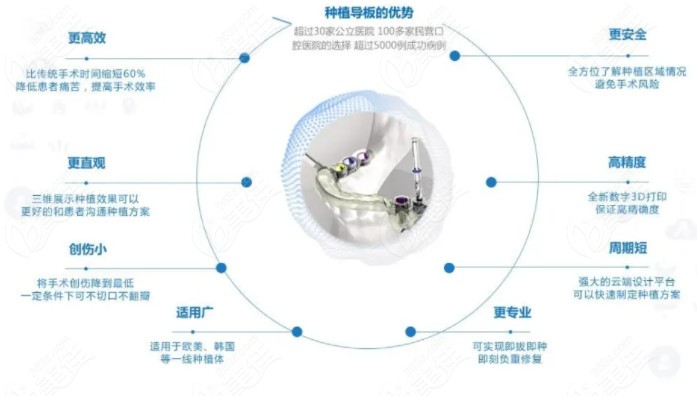 3d数字化导板种植牙的优势