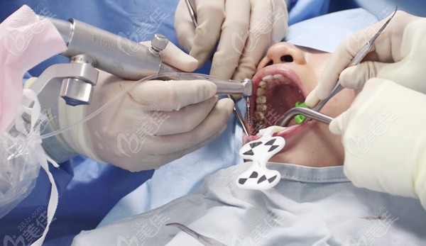 瑞医博口腔种植手术机器人成为国内首款种植牙机器人获批产品