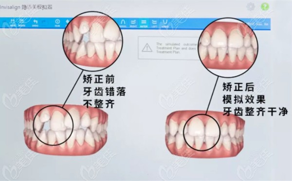 终于寻到丽水市区口腔医院的收费价目表了,矫正牙齿多少钱也在其中