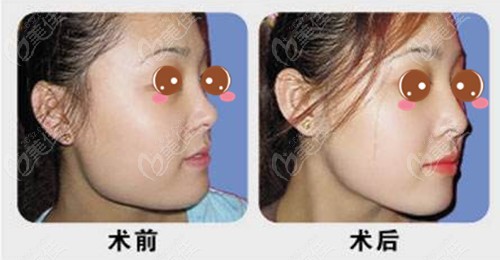 郑州做削骨手术比较好的医生都集中在金水区这两家医院