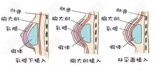 焦俊光医生能做丰胸吗南宁美丽焦点给的个人资料说他做假体隆胸不错呦