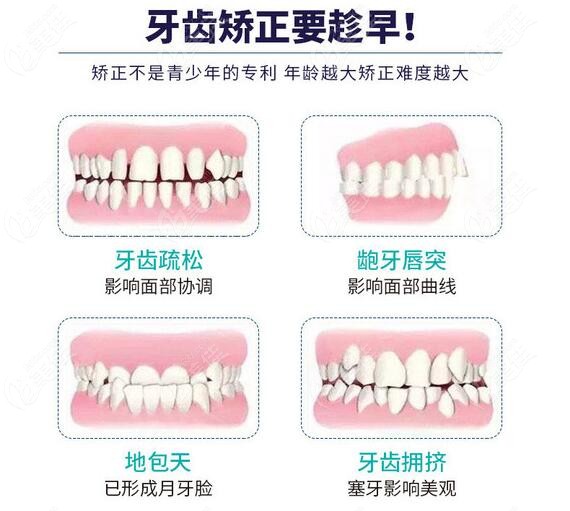 北京通州牙齿矫正价格一般多少钱