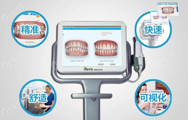 唐山牙博士进口itero口扫设备优势