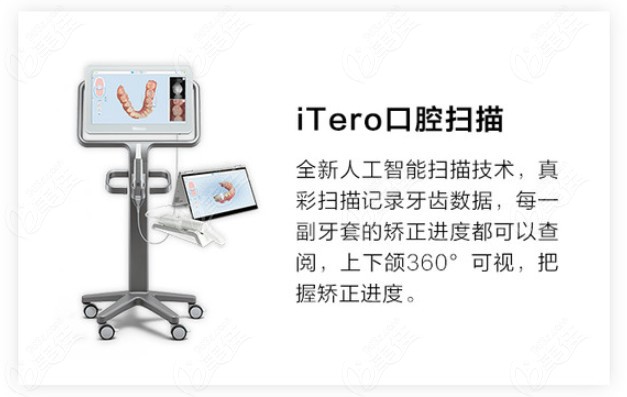 进口隐适美itero口扫设备的优点