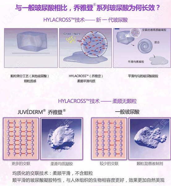 乔雅登玻尿酸