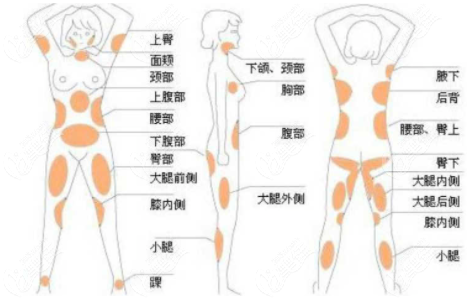 天津美莱于双全吸脂怎么样呢?他做抽脂价格不贵还不反弹
