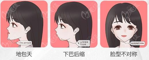 镶牙收费价目表