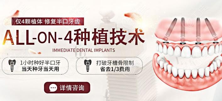 你没听说吴海珍医生做即刻种植牙病例都过万了哎