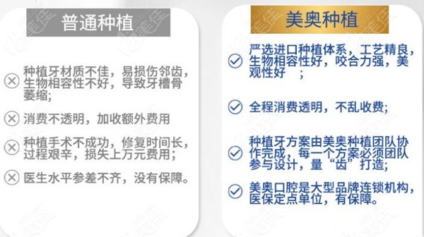 苏州美奥种植牙