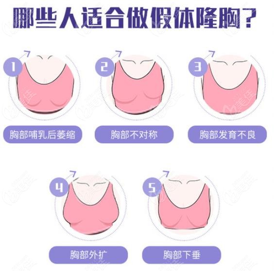 贵阳华美紫馨整形隆胸技术怎么样听说它是贵州丰胸价格不贵的医院