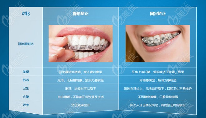 当然此价格像美莱,齐尔口腔都能参考哦; 杭州隐形牙齿矫正价格就在