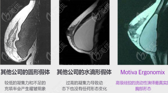 韩国芭堂整形隆胸手术失败了可魔滴假体丰胸很受欢迎是我了解到的