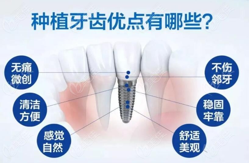 阳江做种植牙和牙齿矫正多少钱已汇总阳江看牙便宜又好的牙科收费