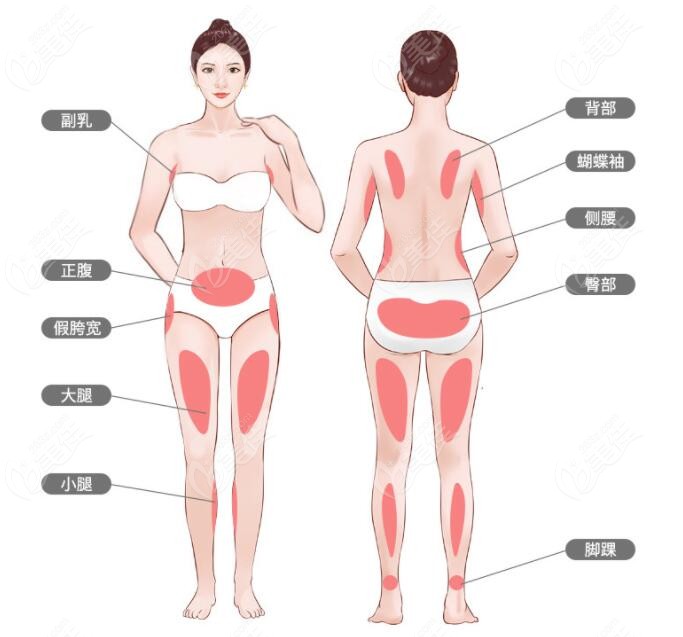 吉林水动力吸脂部位