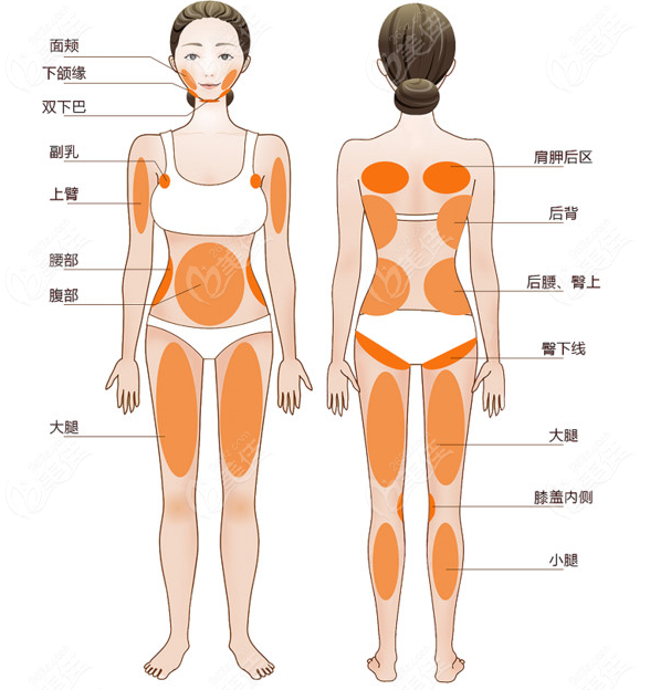 太原丽都做全身吸脂的部位