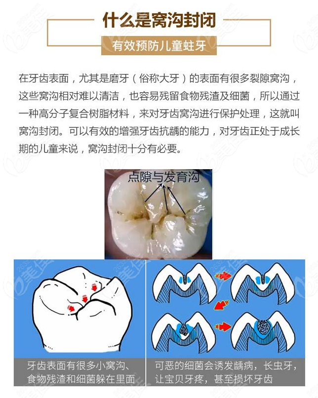 芜湖补一颗牙多少钱