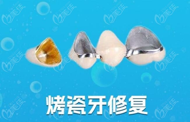 烤瓷牙项目