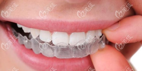 中汉口腔优惠之牙齿矫正