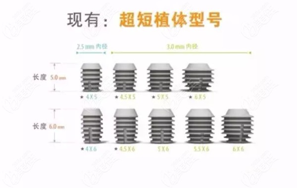 多普勒种植体型号