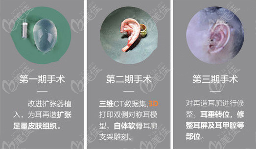 上海全包法耳再造价格及方法