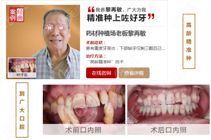 广州广大口腔医院种牙怎么样