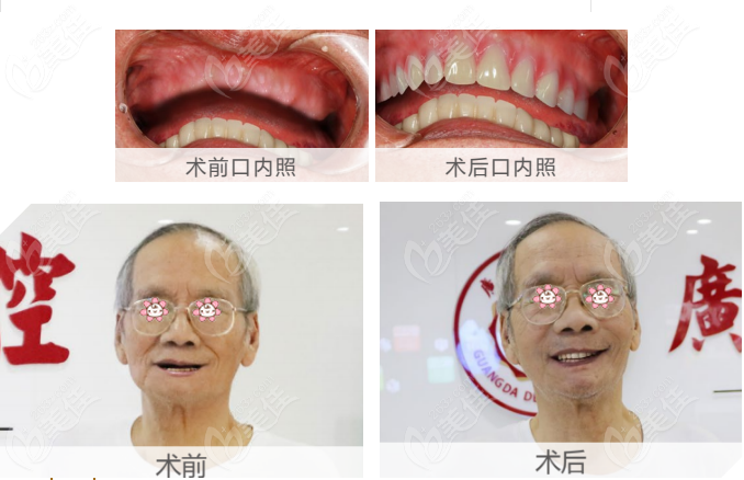 广州广大是广州种植牙技术好的医院