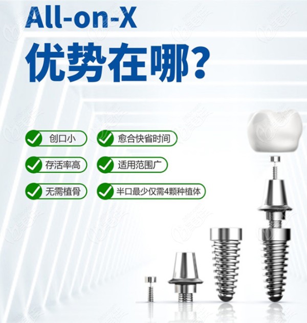 All-on-4种植牙技术优势