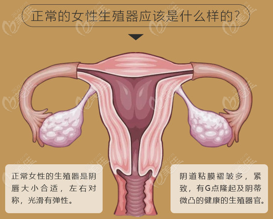 女性私密整形手术