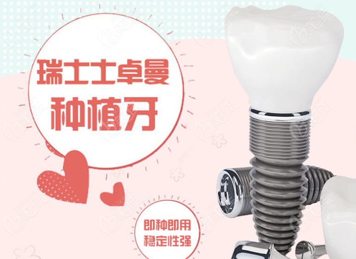 贝臣口腔的种牙优势
