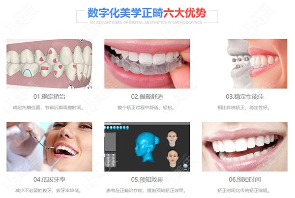 藍(lán)天口腔數(shù)字化美學(xué)正畸優(yōu)勢