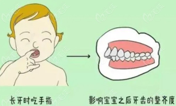 儿童乳牙期可进行牙齿矫正