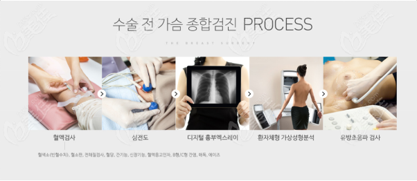 韩国the整形外科卡奇隆胸过程
