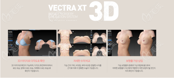 韩国the整形外科卡奇隆胸五代主刀医生玉在镇3D模拟技术