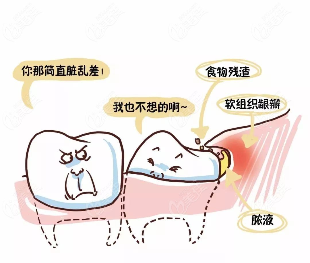 在南通拔智齒牙多少錢一顆各口腔醫院的拔牙價格表已公佈