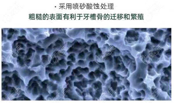 美國皓圣種植體表面處理
