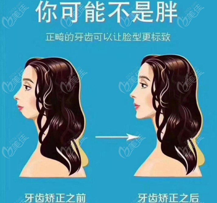 40歲以后還能矯正牙齒嗎